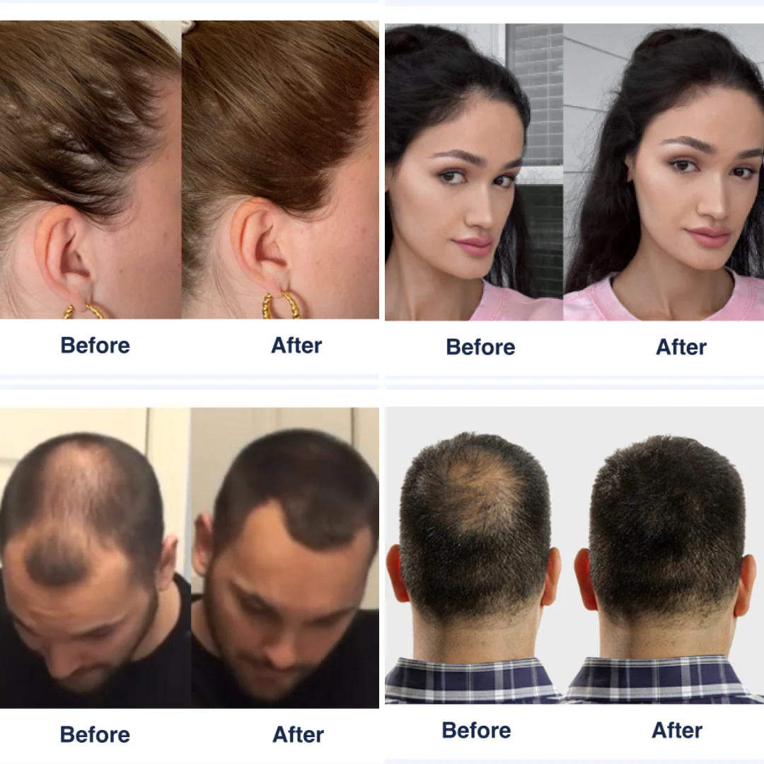 KeraFiber Hair Building Fibers - Image 4